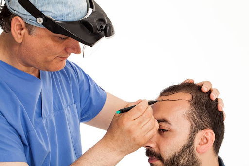 sanju09232's tweet photo. No bleeding. No scars. No pain. No stretches. 100% Natural Hair growth at Sure Growth Zirakpur
Click Below to get more details #Hairtransplant #hairsolution #Haircut #hairstyle 
https://t.co/JcNbwNW0hE https://t.co/dM0PGzhfz4