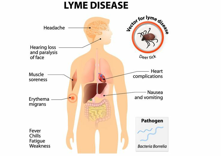 lyme disease is the fastest growing bacterial infection which can cause a whole spectrum of neuropsychiatric symptoms.