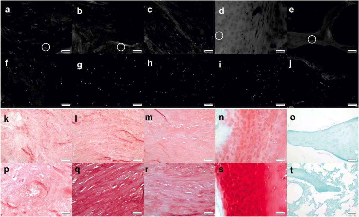 Figure 8 from the paper demonstrating stunning histology of human IVD samples!