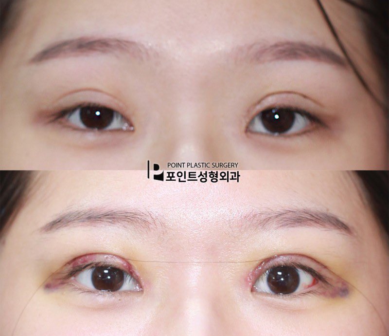 目修正 بحث في تويتر