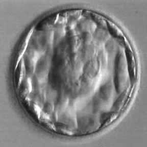 InsideIvf's tweet photo. Happy Sunday 💫 let's celebrate with this beautiful day 5 blastocyst 🤗 #IVF #embryo #SundayMotivation https://t.co/B8D91hIcit