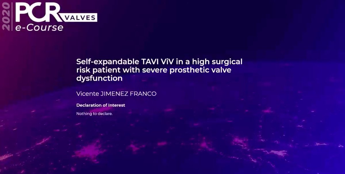 vicentejmzmd's tweet photo. #PCRValves 2020 just launched! Happy to present 3 interesting cases from our cath lab @ University Hospital Ramon y Cajal  @PCRonline https://t.co/CqFD0ulLu1