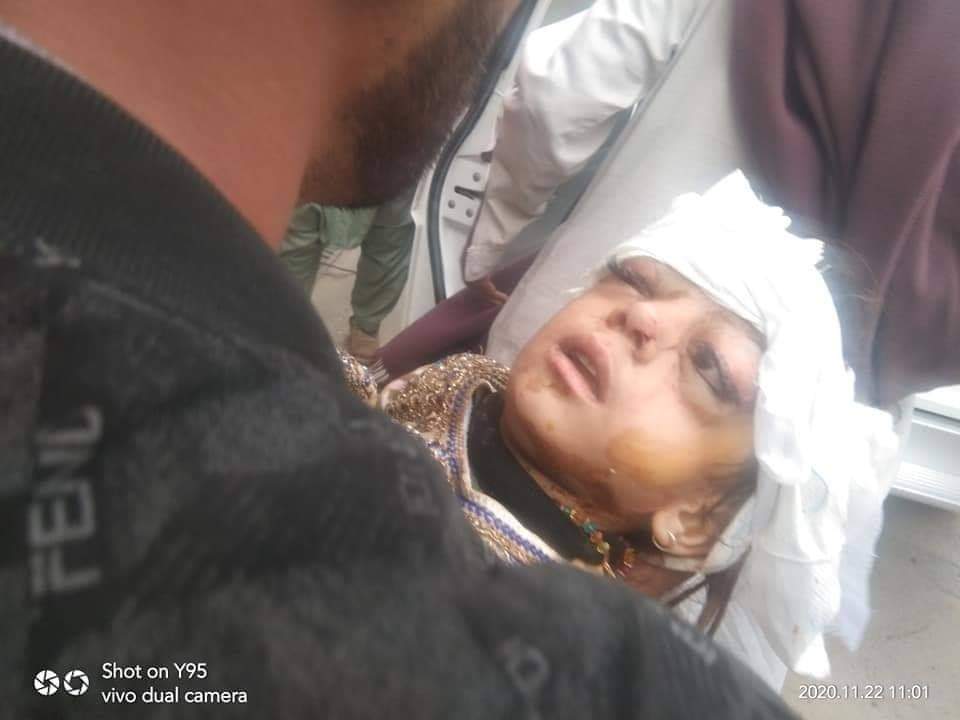india_exposing's tweet photo. Reportedly heavy Indian artillery shelling is going on in kuirata sector on the Cease fire line in Kashmir.   People can hear the artillery sounds in Chamb....

Many civilian casualties on our side ..... This child was killed in the morning today....🤬🤬🇵🇰🇵🇰 https://t.co/FI4ClxtiMS