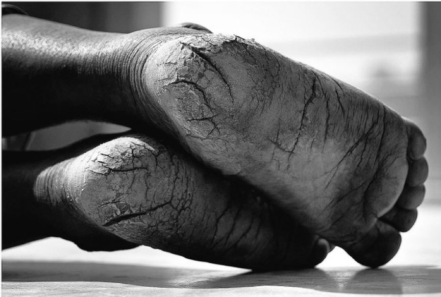 SatOnMeeting's tweet photo. Give it a thought: 
 ... If you were HOMELESS, by tonight, you would've walked an average of 5 miles 😔
#compassion #homelessness #awareness 
#CountYourBlessings 
#Gratitude #DonateToShelters #Compassion #DoNotBeABystander 💖 https://t.co/sDeKNvHbGL
