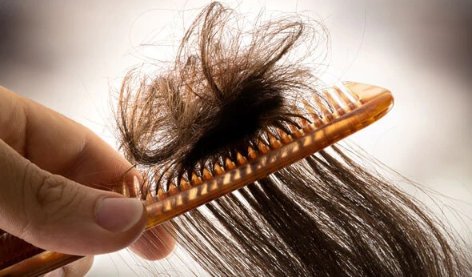 DermaSolutiongh's tweet photo. Say Goodbye To Tangles
Let's get rid of these once and for all;
•Dandruff
•itchy scalp
•Scalp psoriasis
•Breaking Hair
Pls Retweet 🙏
Ghc 40
DM or Call 0205773069
#DermaSolution
#Join1VirtualRally #GPLwk2 https://t.co/BKf17dDuVV