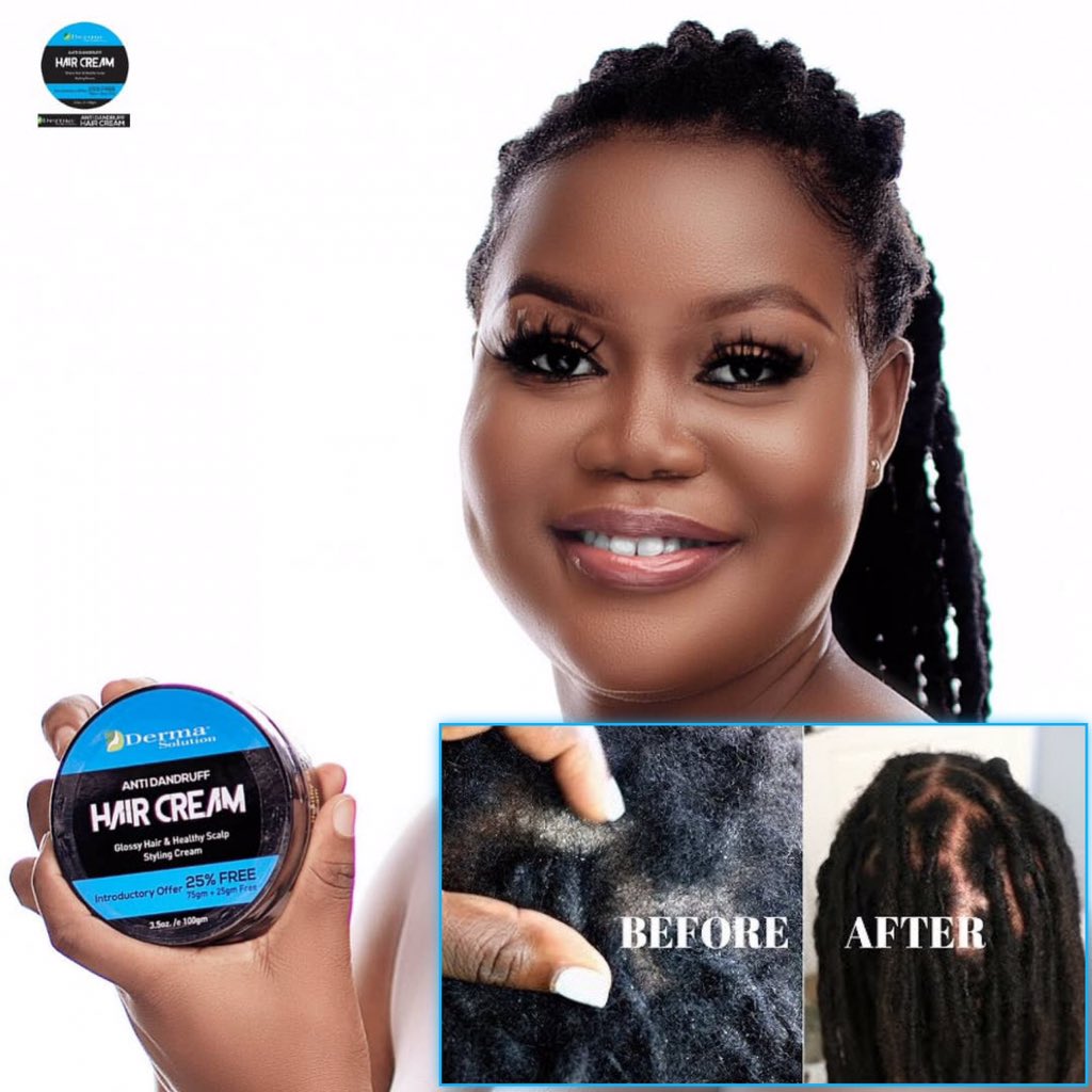 DermaSolutiongh's tweet photo. Say Goodbye To Tangles
Let's get rid of these once and for all;
•Dandruff
•itchy scalp
•Scalp psoriasis
•Breaking Hair
Pls Retweet 🙏
Ghc 40
DM or Call 0205773069
#DermaSolution
#Join1VirtualRally #GPLwk2 https://t.co/BKf17dDuVV