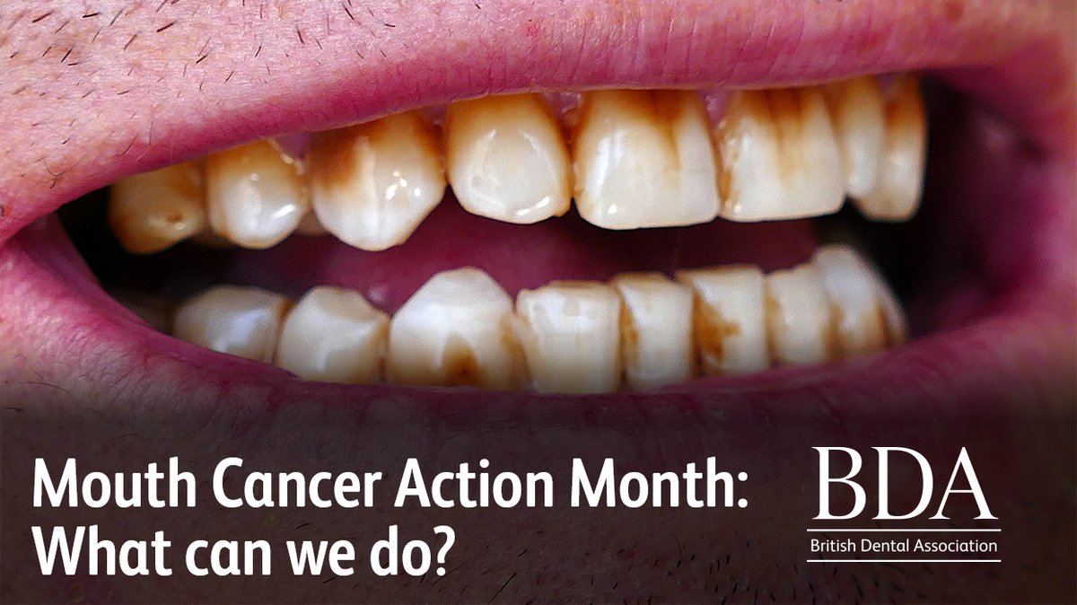 BDA (@thebda) on Twitter photo The Oral Health Foundation’s campaign encouraging more people to self-check for mouth cancers might be critical for early detection and to combat the potentially devastating rise in cases.
Read more here: bit.ly/2HhdSFV
<a href="/dentalhealthorg/">Oral Health Foundation</a> #MouthCancerAction The Oral Health Foundation’s campaign encouraging more people to self-check for mouth cancers might be critical for early detection and to combat the potentially devastating rise in cases.
Read more here: bit.ly/2HhdSFV
<a href="/dentalhealthorg/">Oral Health Foundation</a> #MouthCancerAction
