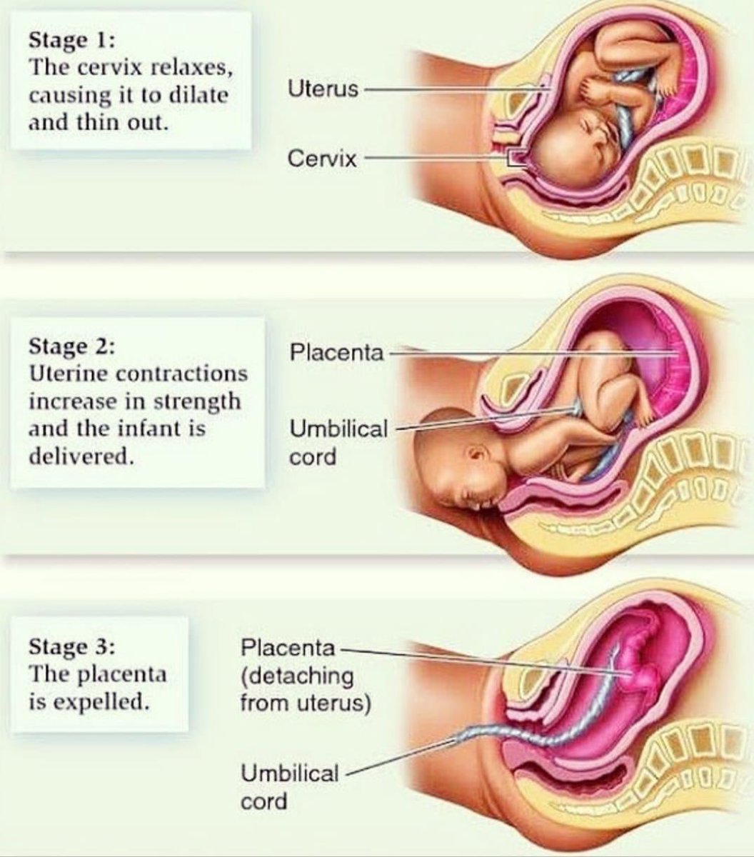 #Labour #stages
Labour has three stages: The first stage is when the neck of the womb (cervix) opens to 10cm dilated. The second stage is when the baby moves down through the vagina and is born. The third stage is when the placenta (afterbirth) is delivered. https://t.co/DXiuw53F7G
