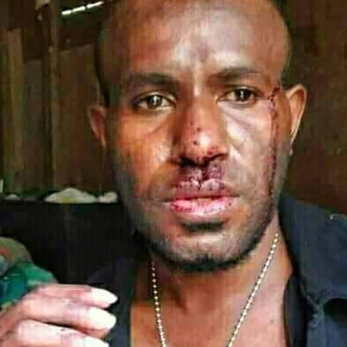 Indonesian security forces attack #Papuan musician, say activists #PacificMediaWatch #papuanlivesmatter #WestPapua #HumanRights @FreeWestPapua @shrek45 asiapacificreport.nz/2020/11/23/ind…