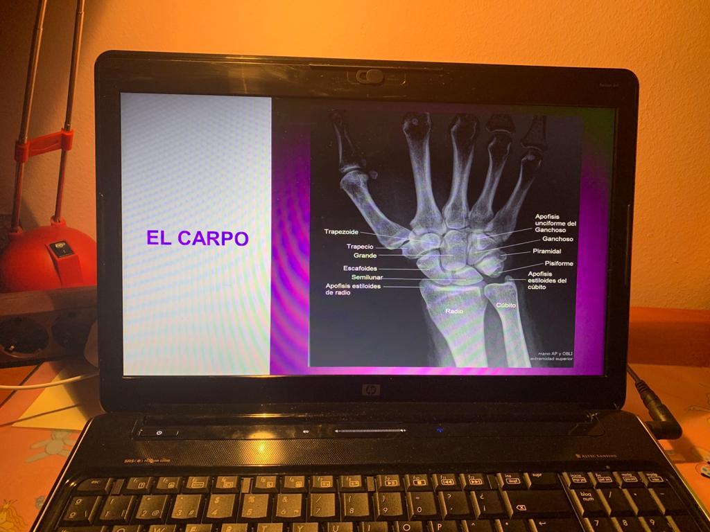 tortxuman's tweet photo. Preparando píldora educativa #onlineULE20 https://t.co/7uk0E86rTW