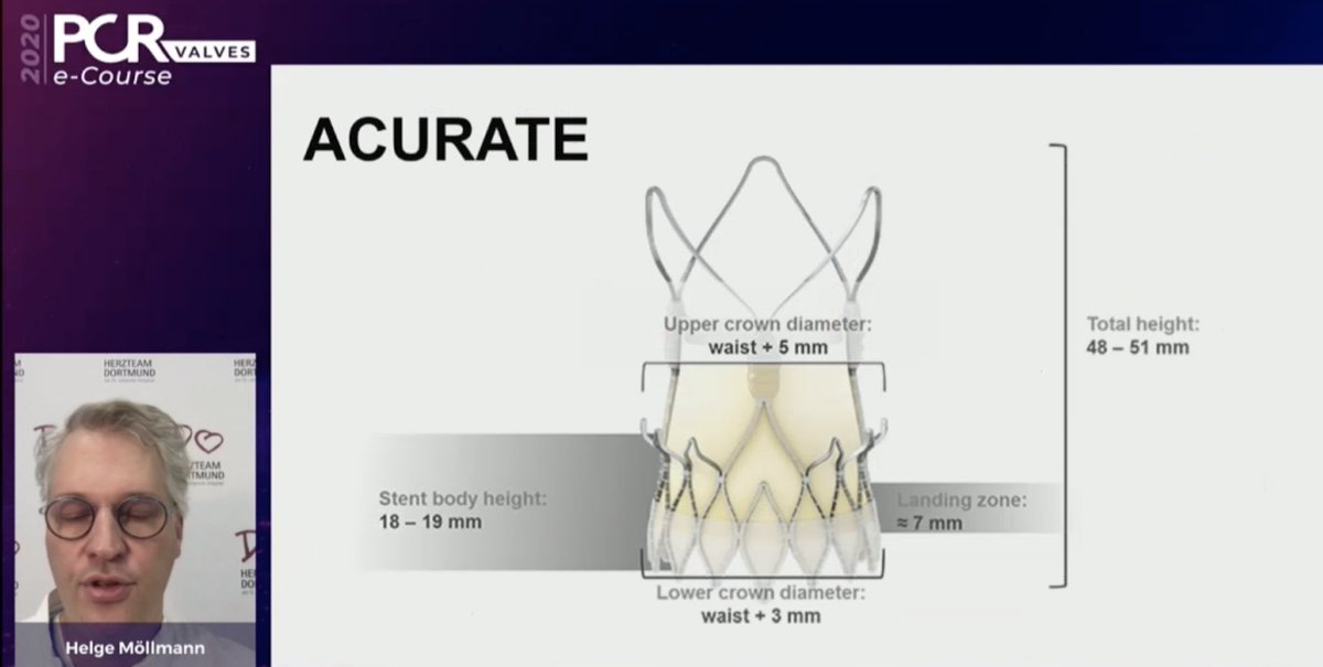 mirvatalasnag's tweet photo. #PCRValves @PCRonline @didier_tchetche @CuissetDr @GilbertTangMD @modine_thomas @DrMoritzWvB
Considerations:
⏫10% will develop ACS in 2 yrs
⏫Valve design & height of implant
⏫ViV different considerations
#REACCESS #ALIGNTAVR https://t.co/Dm9hFI64Ud