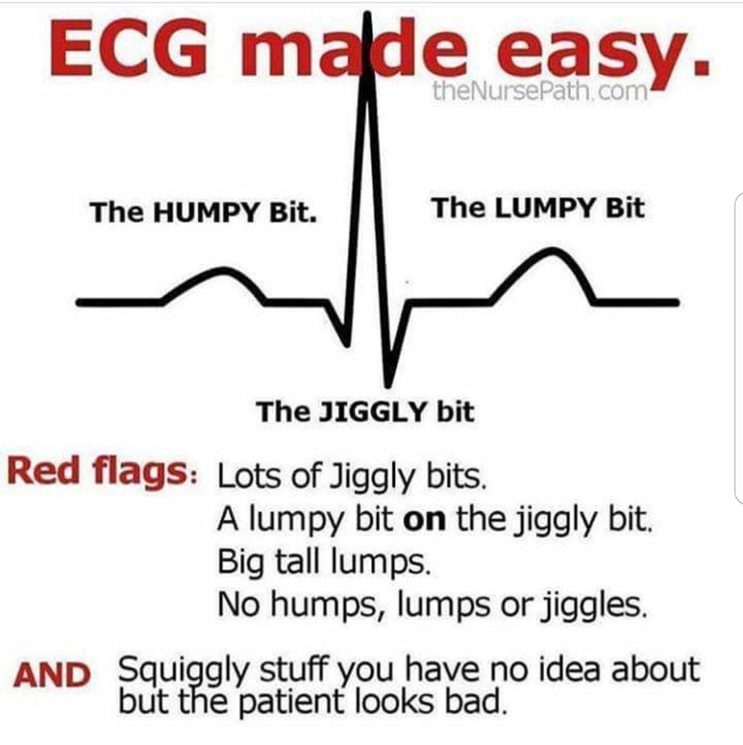 Last min spaces- ECG course 24th NOV - APs / ATs get OT - @BNSSG_SWASFT @Glos_SWASFT @Newquay_swasFT @NE_Devon_Swasft @SWASFTHART mailchi.mp/19971bb46497/n…