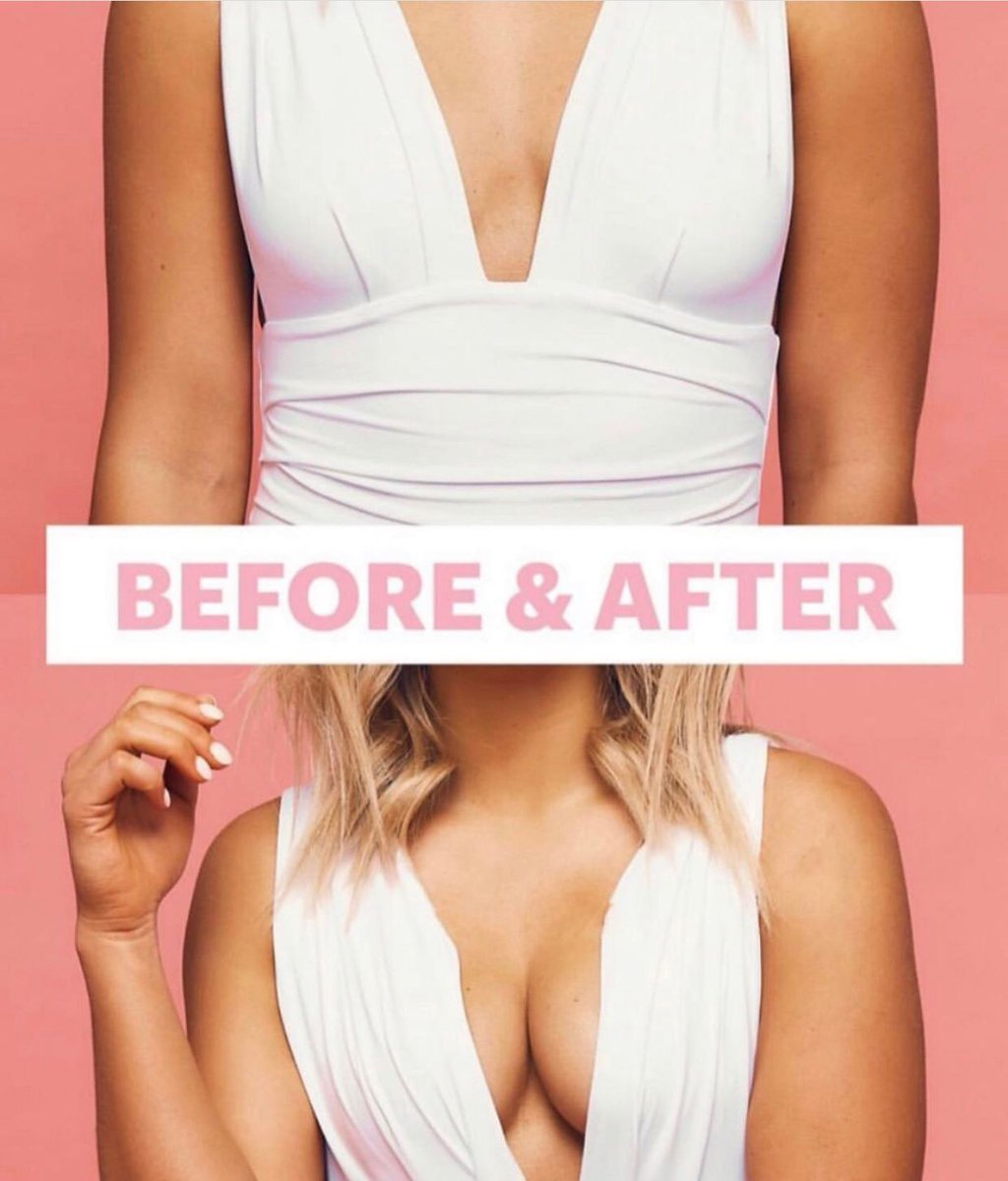 inspiredbdtape's tweet photo. Get an amazing lift without a surgery with our boobstape. Available in different colors https://t.co/FSVRMQyFBg