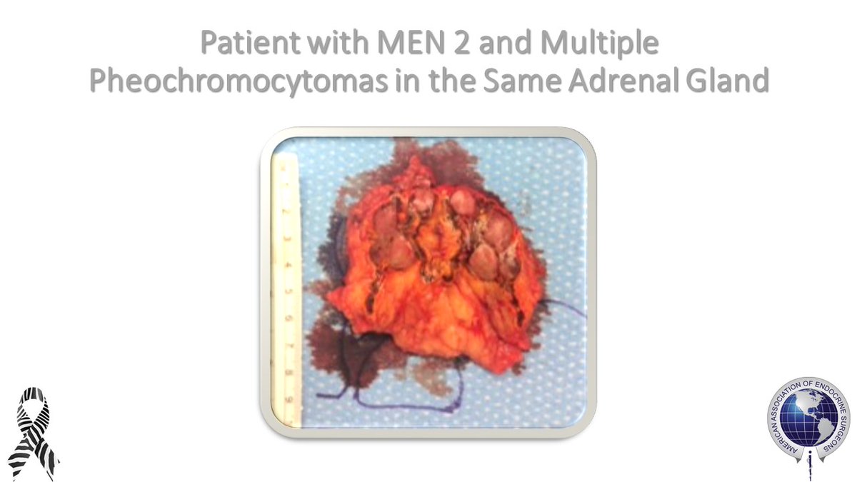 American Association of Endocrine Surgeons tweet media