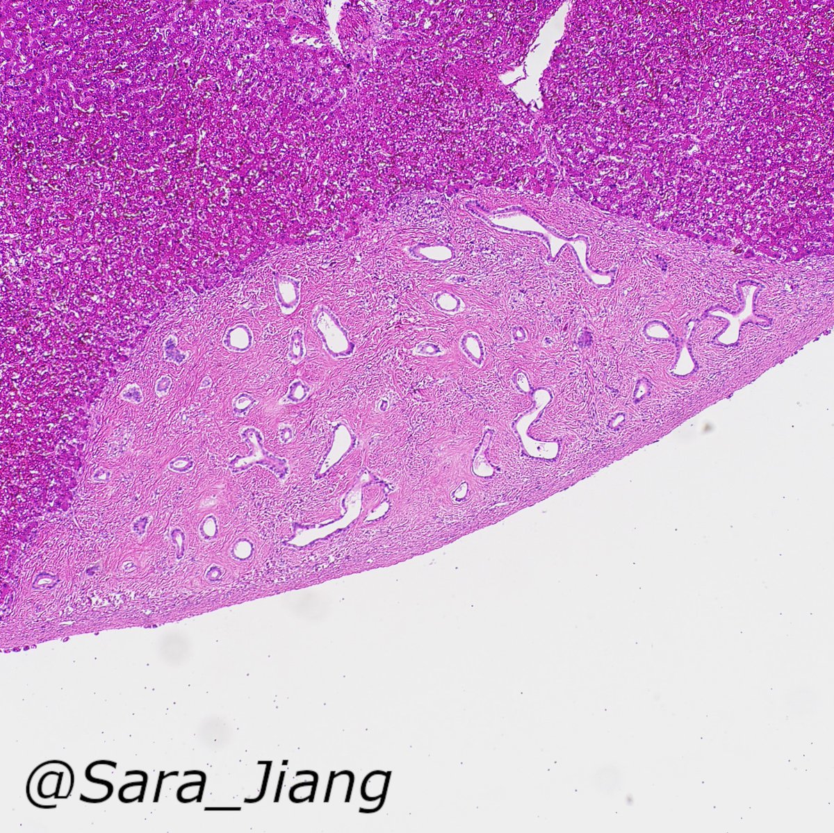 Xiaoyin "Sara" Jiang, MD (She/Her) tweet media