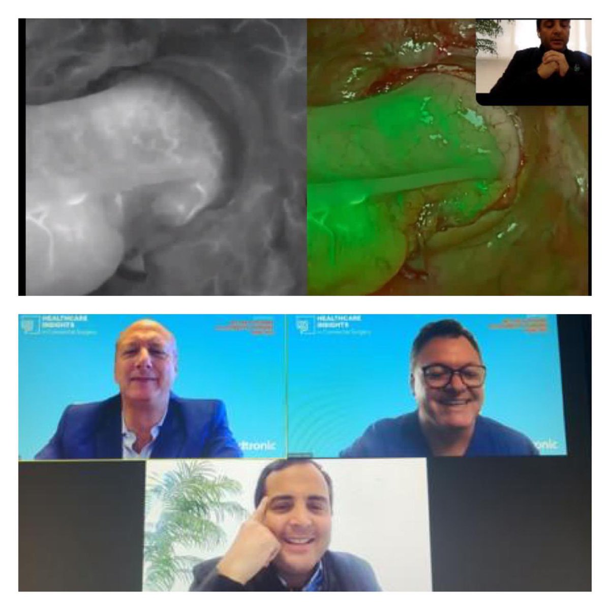 drhomerorod's tweet photo. Educación médica continua, nuevas tecnologías y trabajo en equipo son la clave para una adecuada atención de nuestros pacientes. Dr. Melani 🇧🇷 y Dr. Marks 🇺🇸 @panamasurgical  @CukierM @emmyarrue @PacificaSalud @isfgs #medtronic #colorectalsurgery #fluorescenseguidedsurgery https://t.co/r5heF6u2ul