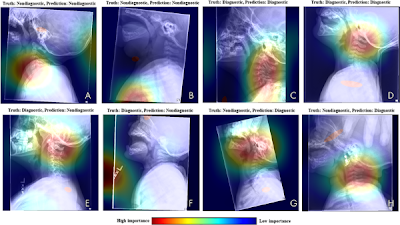 Radiology_AI's tweet photo. A #DL-based algorithm identifies poor-quality pediatric lateral airway radiographs https://t.co/BLwefXAQJ1 @chezhipower @CincyKidsRad #Quality #QI #RadAI https://t.co/isPYtIqzw6