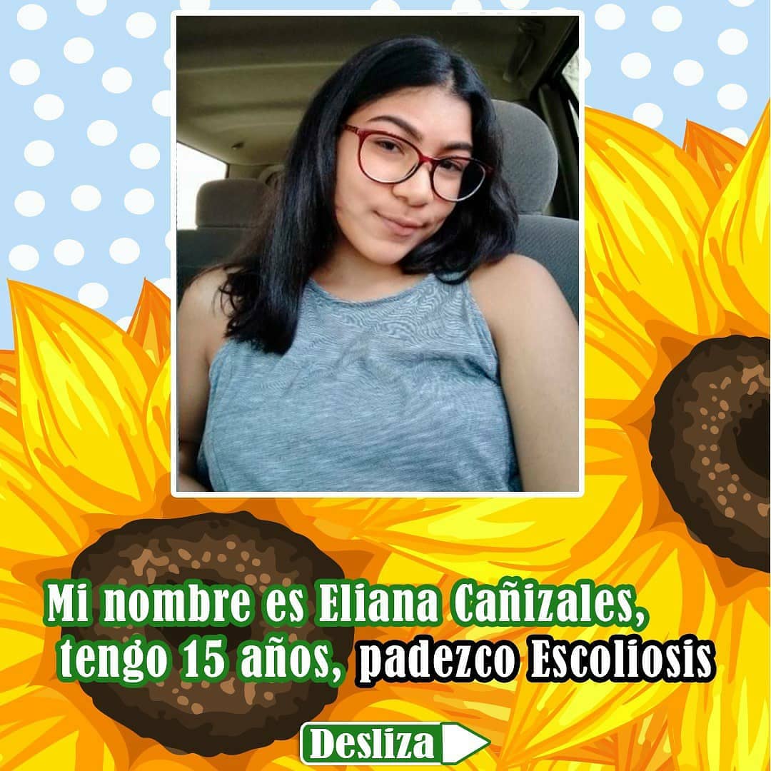 ZulyHurtado1's tweet photo. @ElAragueno buenos días, por favor mi hija Eliana Cañizalez necesita una intervención quirúrgica que requiere con urgencia, padece de ESCOLIOSIS IDIOPATICA DEL ADOLESCENTE y debe ser operada de su columna vertebral, ayudenme a compartir la información, gracias https://t.co/u21AoUfjpF