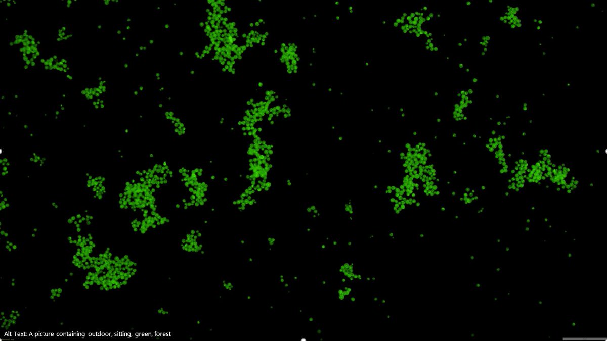 juliannemegaw's tweet photo. Powerpoint auto-generated alt-text says this image contains "sitting". If by "sitting" it means "initial biofilm attachment", it's absolutely right. #archaea #haloferax #GFP https://t.co/txDJ3obwF9