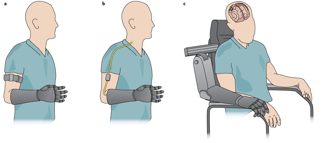 _smicera's tweet photo. Really proud of this #review paper on #sensory #Feedback in #bionic #neuroprostheses #hands just published in @natBME written with @slimanjbensmaia and @FNILab (Dustin Tyler). I hope it will be useful for the field. For sure I enjoyed writing it!
https://t.co/56Rn6jNmBI https://t.co/sDCJM1jT2A