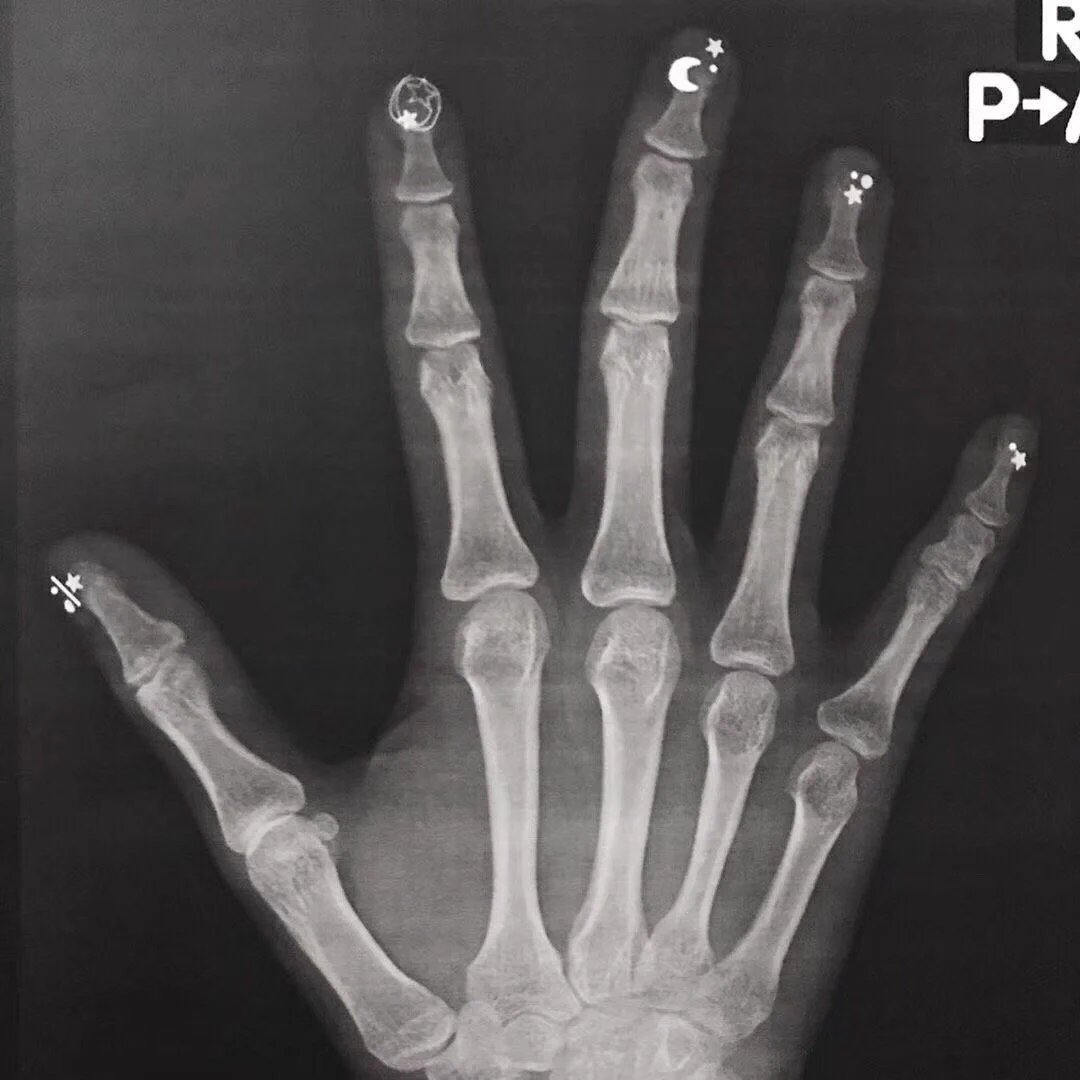 ファンタジー！ネイルアートをしてレントゲンを撮ったら、こんなことに…！