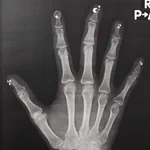 ファンタジー!ネイルアートをしてレントゲンを撮ったら、こんなことに…!