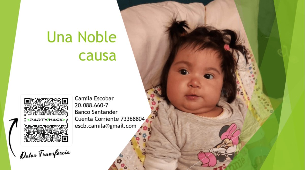 Party_Hack's tweet image. Hoy estamos en una noble causa que se llama Leonor @mami_caami que sufre de artrogriposis múltiple congénita lo que significa es que esta enfermedad es tan especial que nació rígida en sus cuatro extremidades.
Haz tu aporte solidario y #AyudemosaLeonor en el webinar de #PartyHack