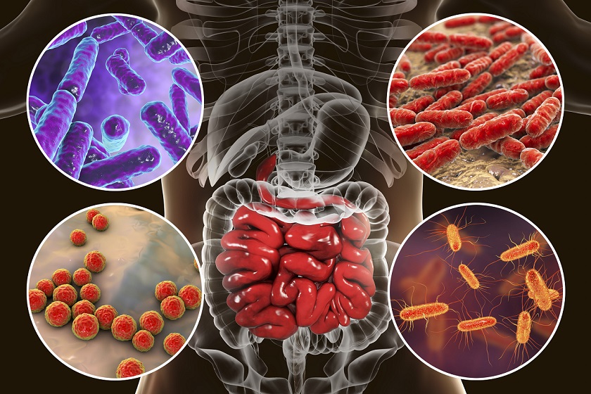 FIP_org's tweet photo. How can we harness the therapeutic potential of gut #microbes? Find out in the new #fipIPJ #pharmacy https://t.co/9wnSubMdqJ https://t.co/GTlGExkWST