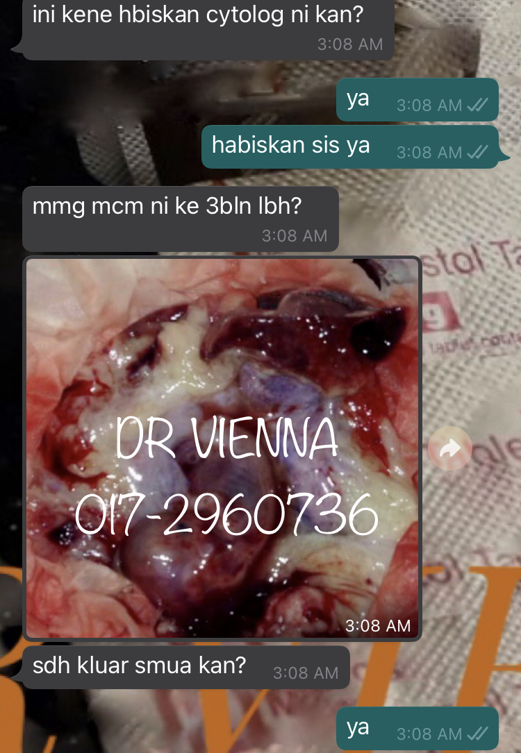 dr_gugur's tweet photo. 0172960736
https://t.co/mIVRQtrujf
pil gugur original, pil gugur paling berkesan, pil gugur penang, pil gugur puchong, pil gugur sabah, pil gugur selain cytotec, pil gugur shah alam, pil gugur trusted seller, pil gugur yang berkesan, pil gugur yang murah, pil gugur yang selamat, https://t.co/ELxWnmtu77