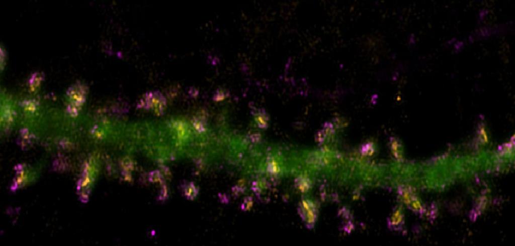NUFeinbergMed's tweet photo. Northwestern scientists determined how two protein mutations, which cause impaired motor function in Parkinson’s disease, independently disrupt neuron activity. https://t.co/euuclqQ5r6 #ParkinsonsDisease https://t.co/LDZyCMRnik