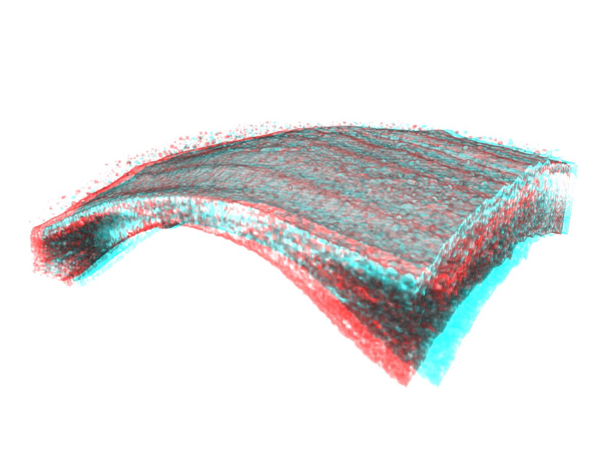 MalocaPeter's tweet photo. Grab your red cyan glasses! Amazing stereoscopic view of #Keratoconus #3DOCT #Retinopsy @IOB_ch with central thinning due to tissue loss. Do you like it? https://t.co/RF11Q6BwWF