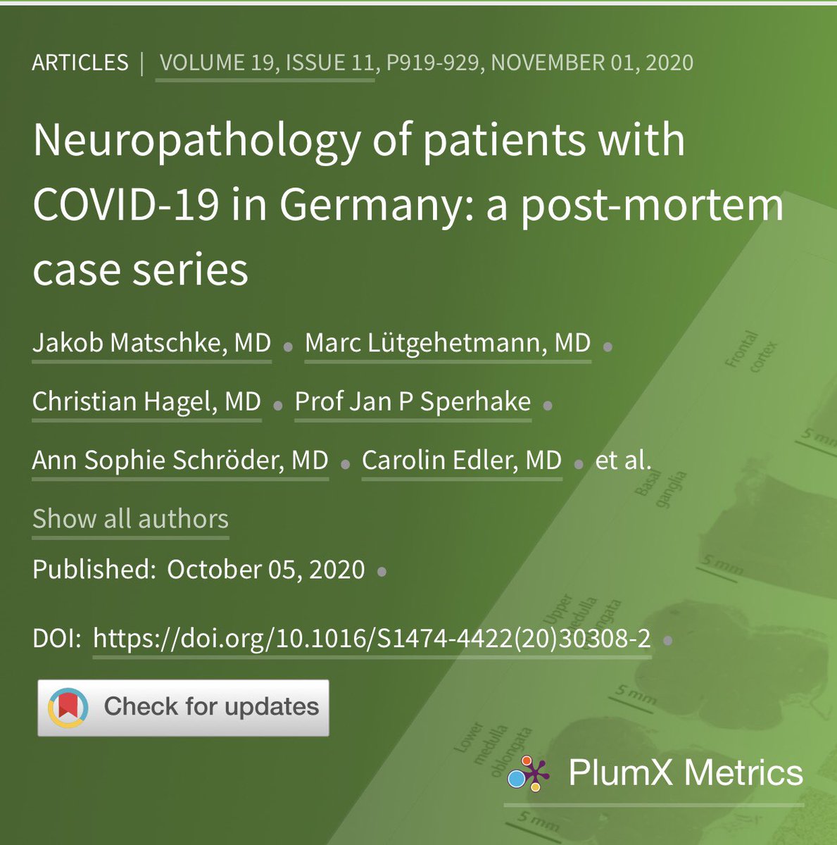 6/ Leading the team to reference this separate Lancet study, which found COVID-19 viral RNA/protein in the brainstem of COVID-19 human patients via autopsy:  https://www.thelancet.com/journals/laneur/article/PIIS1474-4422(20)30308-2/fulltext