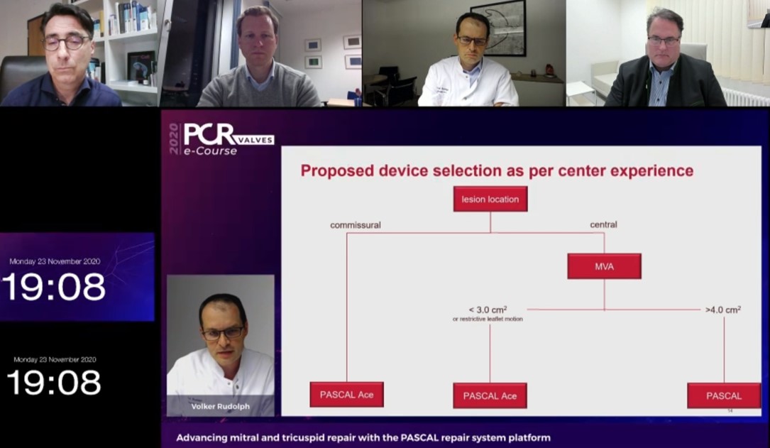 vonBardelebenRS's tweet photo. #PASCAL selection at #PCRonline #PASCAL_ACE in #mitralvalve #tricuspid #TMTT focus on #anatomy and #repair try to achieve #MR1+ https://t.co/w4NiakTGmx