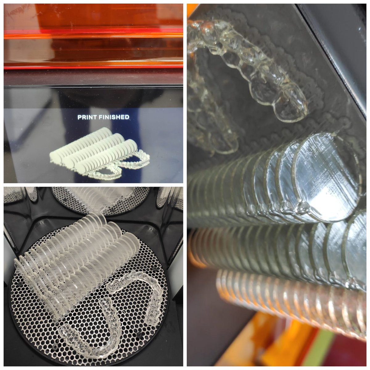 Dijitalizasyon hızlandıkça üniversitelerimizin çok kıymetli, öncü inovatif çalışmaları da bu yönde şekilleniyor.Splint materyallerinin biyouyumluluğu konusunda Atınbaş Üniversitesi  Dr Ayşe Atay ve Dr Demet Ayvalıoğlu  hanımların araştırmasın da   yer aldığımız için çok mutluyuz.