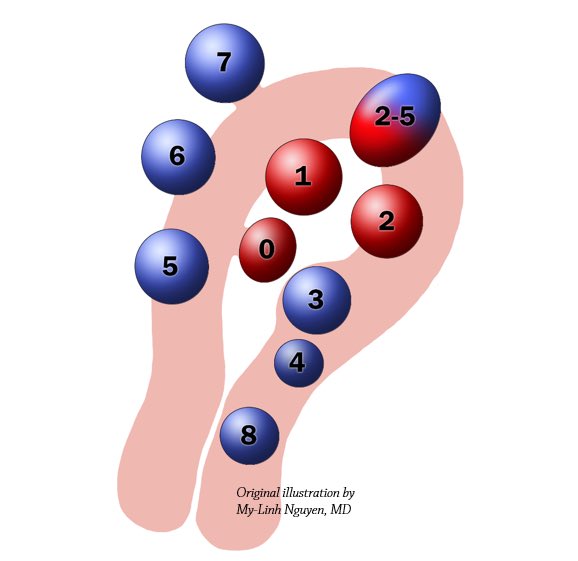 My-Linh Nguyen, MD (@radiologydoc) on Twitter photo Sneak peek of an original illustration from our accepted manuscript: “MRI-Based Pictorial Review of the FIGO Classification System for Uterine Fibroids.” Congrats <a href="/ErinGomezMD/">Erin Gomez, MD</a> <a href="/KatarzynaMacura/">Katarzyna Macura</a> @DzmitryFursevi1! What an honor to collaborate with you. <a href="/PermanenteDocs/">PermanenteDoctors</a> <a href="/KPMidAtlantic/">Kaiser Permanente</a> Sneak peek of an original illustration from our accepted manuscript: “MRI-Based Pictorial Review of the FIGO Classification System for Uterine Fibroids.” Congrats <a href="/ErinGomezMD/">Erin Gomez, MD</a> <a href="/KatarzynaMacura/">Katarzyna Macura</a> @DzmitryFursevi1! What an honor to collaborate with you. <a href="/PermanenteDocs/">PermanenteDoctors</a> <a href="/KPMidAtlantic/">Kaiser Permanente</a>