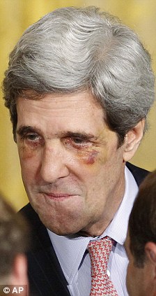 DailyTruthRpt's tweet photo. Black Eye Club. https://t.co/IA8nv532A3
