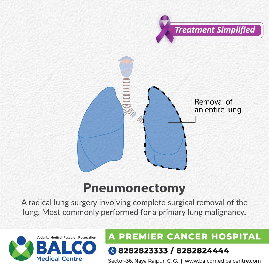 BalcoMedical's tweet photo. At #BMCRaipur, our #expert cancer surgeons perform pneumonectomy, the technically complex procedure in our state-of-the-art OT complex.

To know more and book an appointment, call 8282823333

#VMRF #Pneumonectomy #TreatmentSimplified #LungCancer #CancerCare #CancerAwareness https://t.co/Jmw2V4PQTa