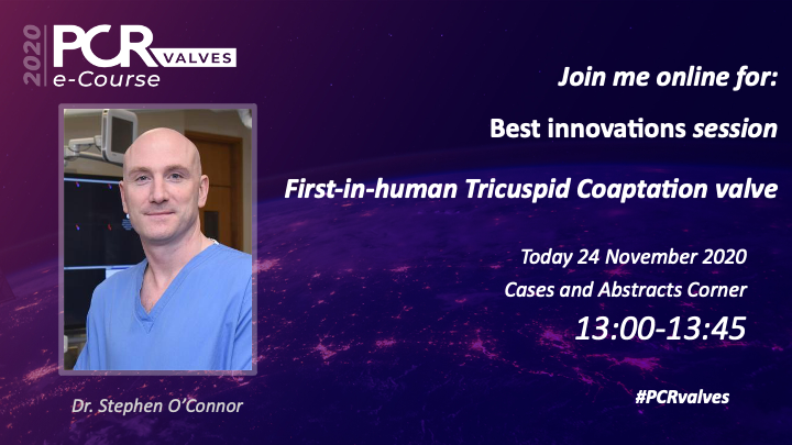 Stephen O'Connor (@stepoco) on Twitter photo Tune in to the Best Innovations Session today at 13:00 CET where I present on behalf the Heart Team <a href="/stjamesdublin/">St James's Hospital</a> our first-in-human experience of a novel tricuspid coaptation valve device <a href="/CroiValve/">CroiValve</a> <a href="/PCRonline/">PCRonline đź«€</a> #PCRvalves <a href="/hensey99/">Mark Hensey</a> #tricuspid <a href="/AndreasRck2/">Andreas RĂĽck</a> <a href="/fjsawaya/">Fadi Sawaya</a> <a href="/sbrugaletta/">Salvatore Brugaletta</a> Tune in to the Best Innovations Session today at 13:00 CET where I present on behalf the Heart Team <a href="/stjamesdublin/">St James's Hospital</a> our first-in-human experience of a novel tricuspid coaptation valve device <a href="/CroiValve/">CroiValve</a> <a href="/PCRonline/">PCRonline đź«€</a> #PCRvalves <a href="/hensey99/">Mark Hensey</a> #tricuspid <a href="/AndreasRck2/">Andreas RĂĽck</a> <a href="/fjsawaya/">Fadi Sawaya</a> <a href="/sbrugaletta/">Salvatore Brugaletta</a>