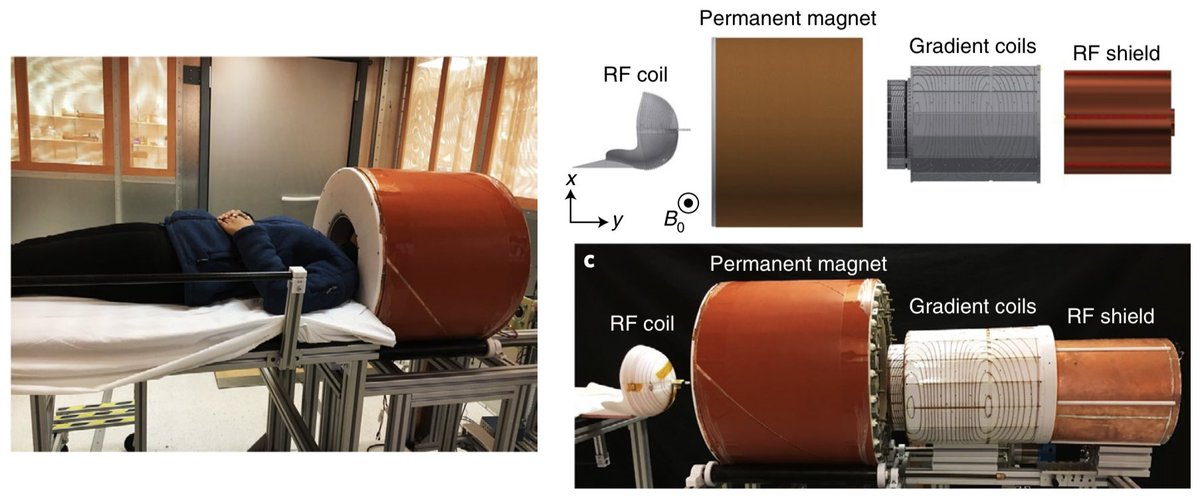 natBME's tweet image. A portable prototype scanner for brain MRI that uses a compact and lightweight permanent rare-earth magnet with a built-in readout field gradient generates clinically relevant images of the brain, as shown in adult volunteers.

rdcu.be/cbfhu