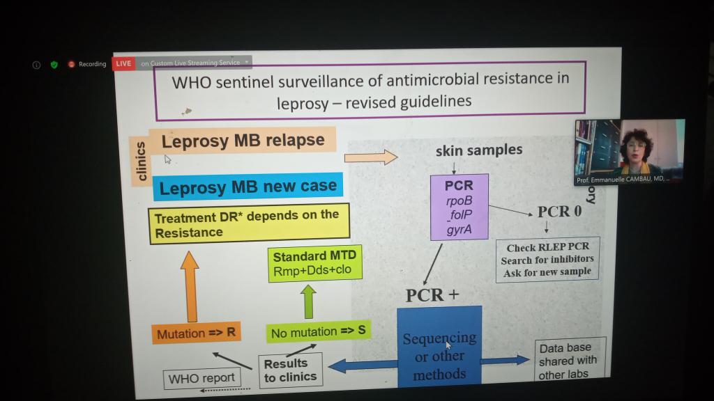 hadgrace's tweet photo. Enlightening presentation from Prof Emmanuelle Cambau of University of Paris #beatNTDs #AMR  #WAAW2020 #AMRweek https://t.co/VV4Jwl0Xxw