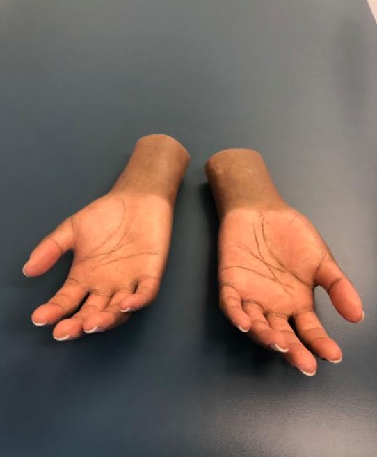 MedicalCenterOP's tweet photo. When we say we use high-definition silicone, we REALLY mean it!
#silicone #siliconehand #siliconehands #siliconeprosthetic #siliconeprosthetics #siliconeprosthesis #siliconeprostheses #prosthesis #prosthetist #amputeepride #moveforward #moveforwardMCOP #prosthetichand #oandp https://t.co/VlH3DHoyEV