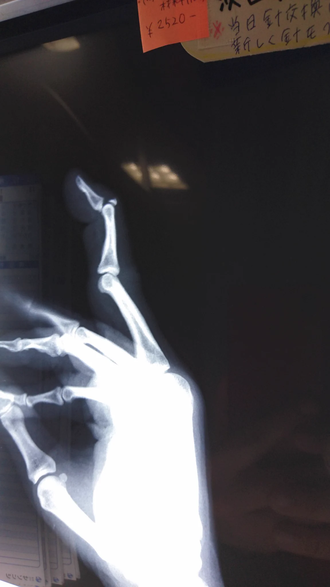 @animenetabot 折れると痛いよね 