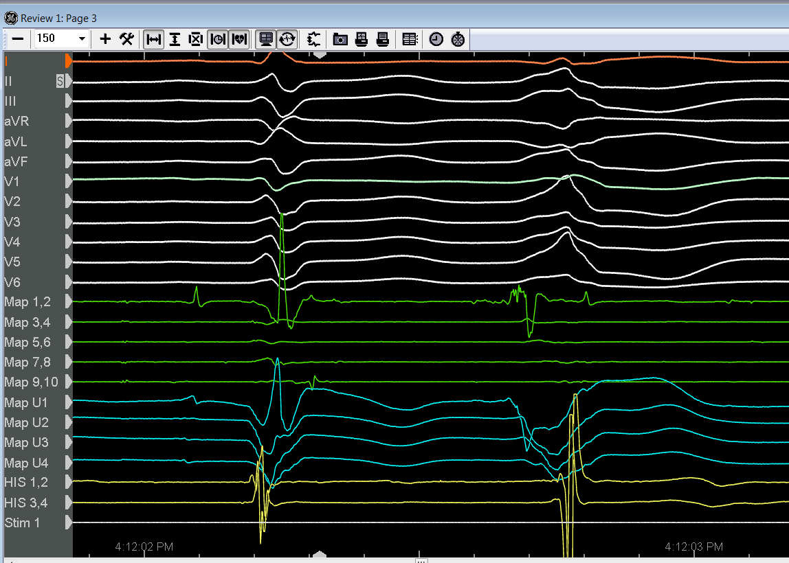 Gregory Michaud on Twitter: