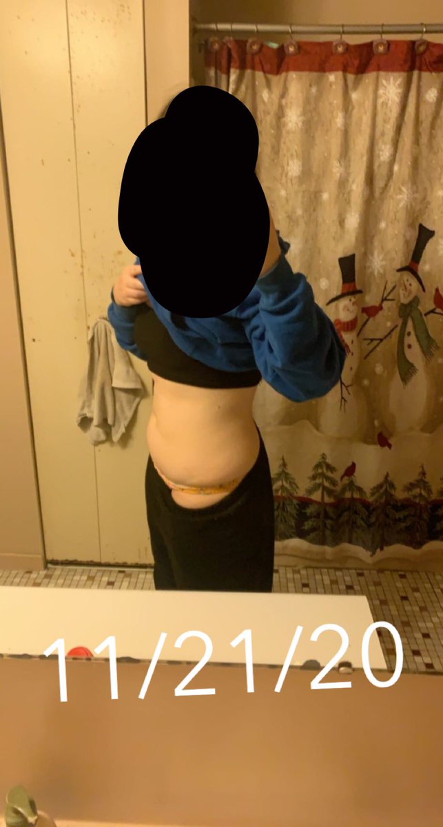 brknlustt's tweet photo. body check # ?? idk lolz
yuh my stomach doesnt look flat at all and i still have a muffin top but— #EDtwt #bodycheck https://t.co/Gff1esmtiQ