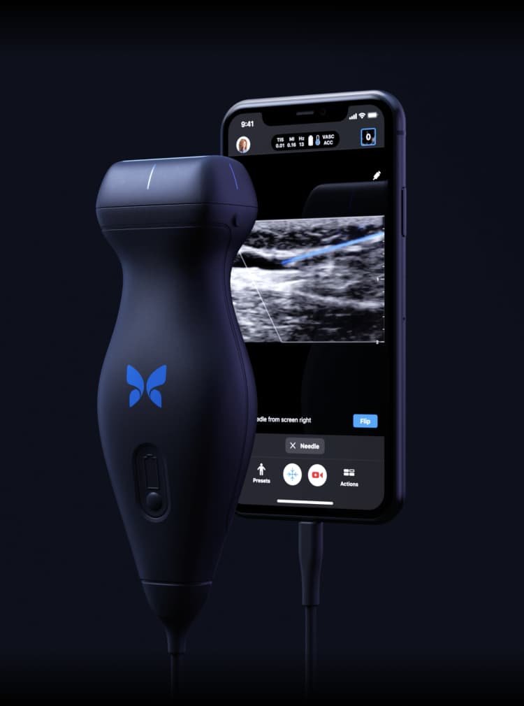 $LGVW to merge w/ @ButterflyNetInc -- a disruptor in ultrasound.Learned about it a few days ago & had a chance to dig in.A thread .