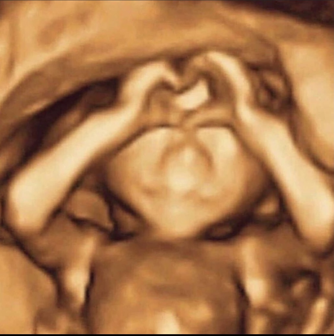 LactationLab's tweet image. "Ten little fingers, ten perfect toes, fill our hearts with love that overflows." 💕

PC: @maternitybeyond via @i.am.pregnant