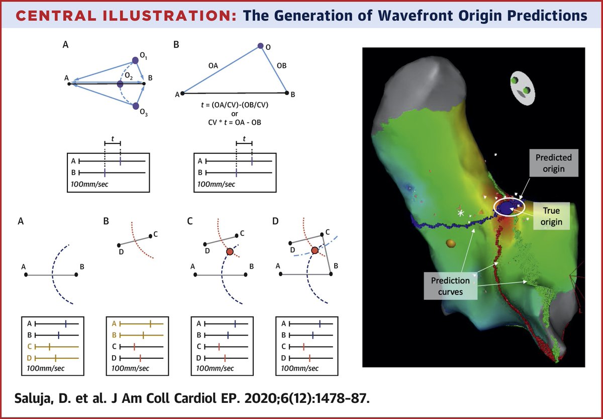 Deepak Saluja (@deepaksalujamd) on Twitter photo Happy to report our paper describing and evaluating a new method to rapidly predict focal wavefront origins just came out in print in <a href="/JACCJournals/">JACC Journals</a> EP. Thanks to @BiosenseWebster for a great collaboration. <a href="/ColumbiaCardio/">Columbia Cardiology Fellows</a> #EPeeps
sciencedirect.com/science/articl… Happy to report our paper describing and evaluating a new method to rapidly predict focal wavefront origins just came out in print in <a href="/JACCJournals/">JACC Journals</a> EP. Thanks to @BiosenseWebster for a great collaboration. <a href="/ColumbiaCardio/">Columbia Cardiology Fellows</a> #EPeeps
sciencedirect.com/science/articl…