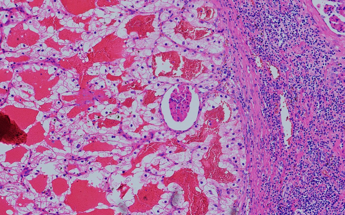 Alex Gallan tweet media