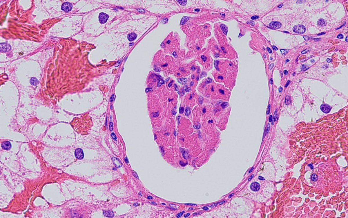 Alex Gallan tweet media