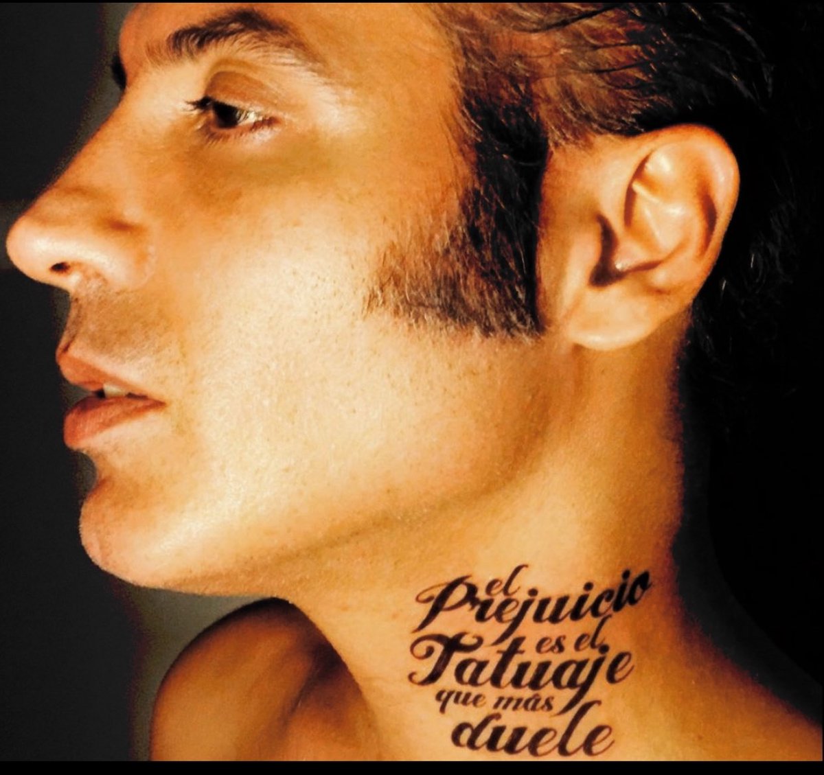 En mi familia somos propensos a queloides y un día me hice daño en el  trabajo y la gente siempre asumía que me lo había hecho yo misma. ¡Por fin  me los, image size:1200x1129